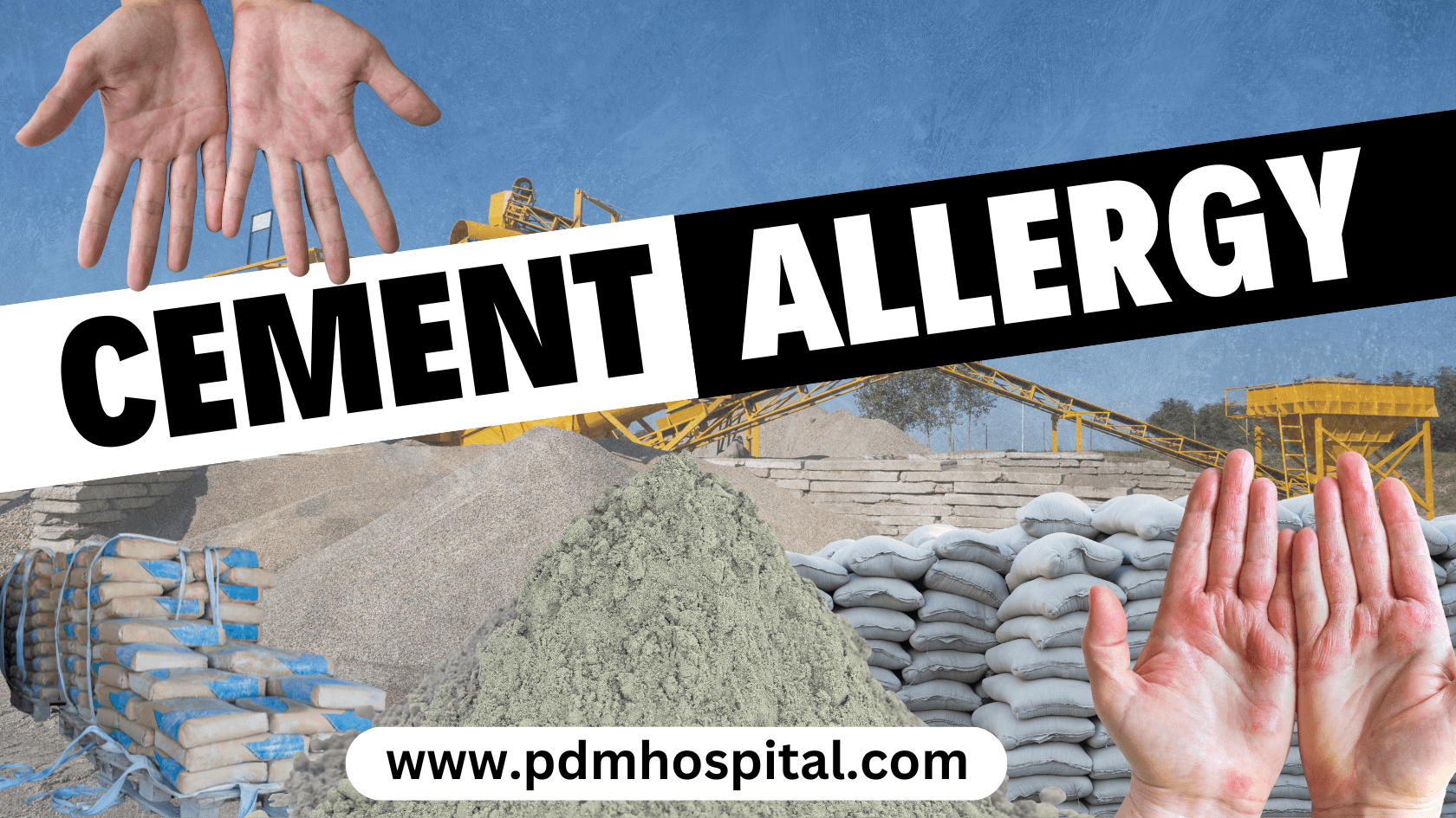 Cement Allergy: Causes, Symptoms, Diagnosis and Treatment